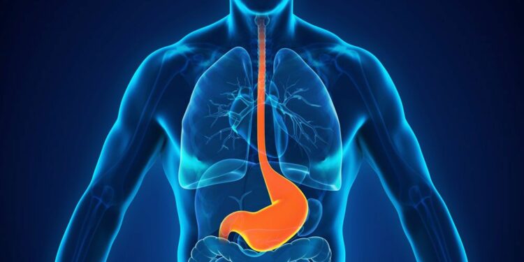 Top 10 Easy Ways To Get Rid Of Acid Reflux Naturally 2022